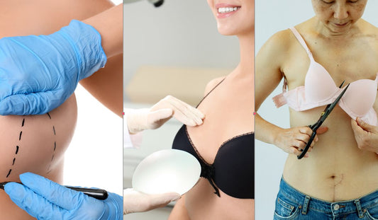 Choosing Between Breast Reconstruction, Prosthesis, or Going Flat